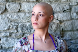 Onkologie Kosmetik - schöne junge Frau mit Glatze